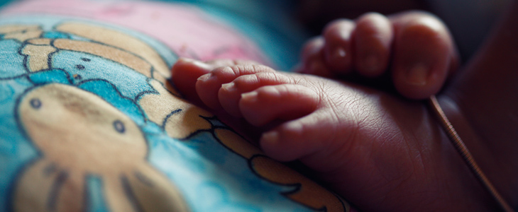 Trattamento della trombosi neonatale, l’importanza della multidisciplinarietà