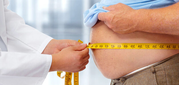 Dosi fisse di NAO nei pazienti obesi: sono davvero sufficienti?