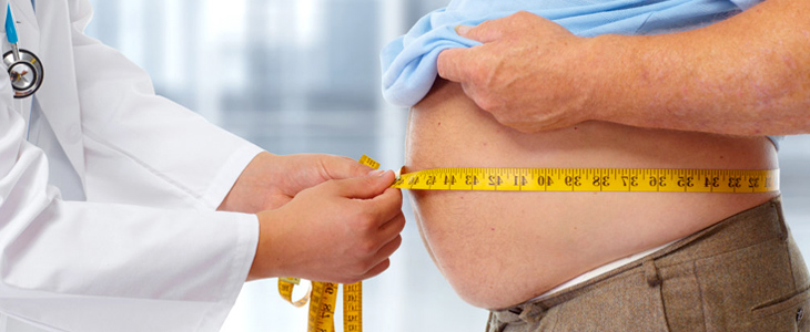 Dosi fisse di NAO nei pazienti obesi: sono davvero sufficienti?