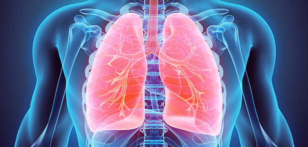 Embolia polmonare